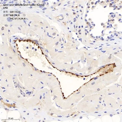 Anti-von Willebrand Factor Rabbit Pab
