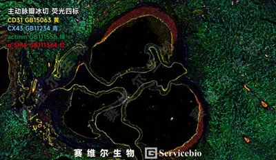 สารชะแอนติบอดีเพื่อภูมิคุ้มกัน